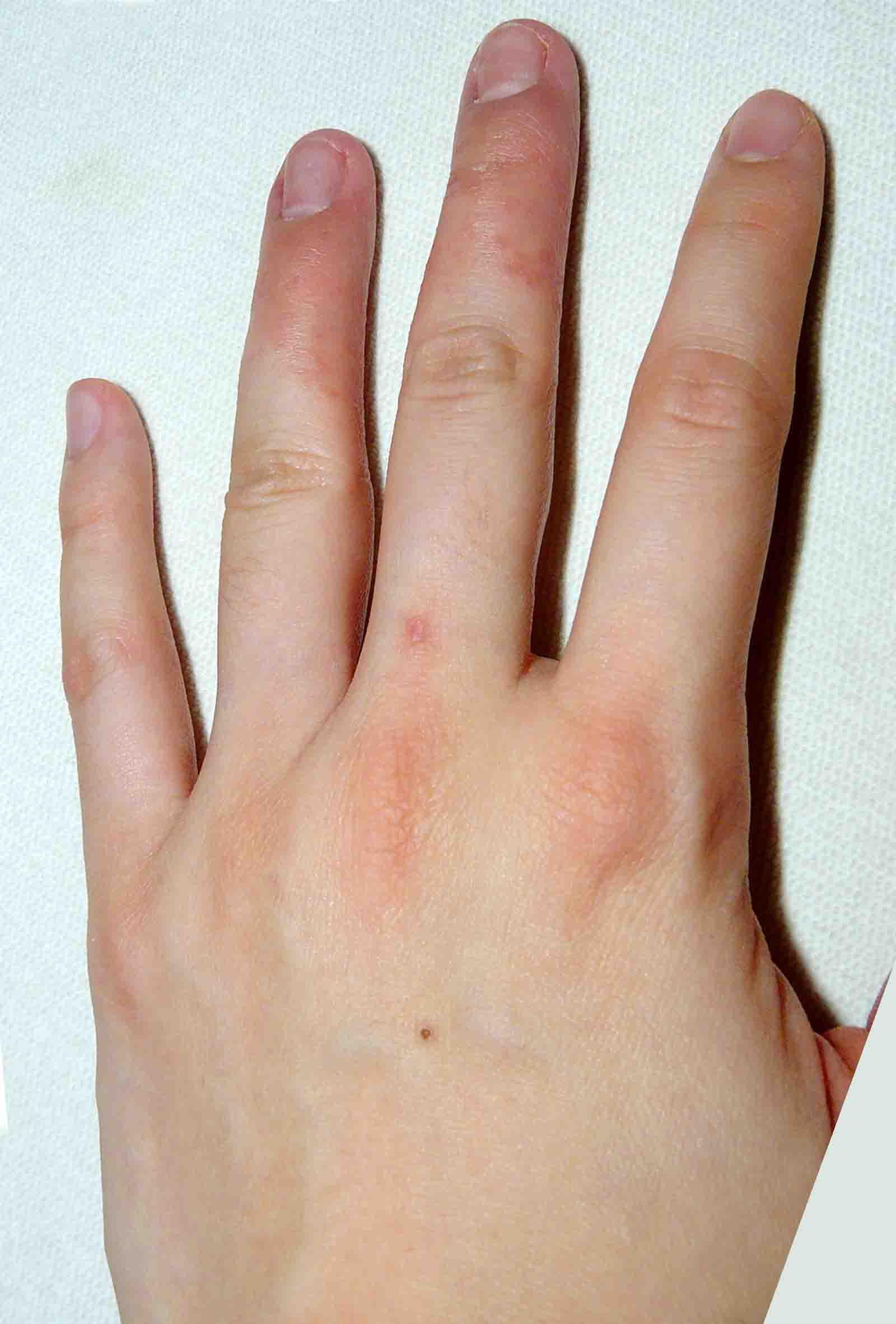 Left Hand Jan 2009